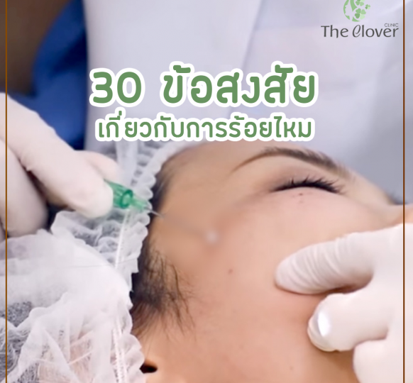 30 ข้อสงสัยเกี่ยวกับการร้อยไหม