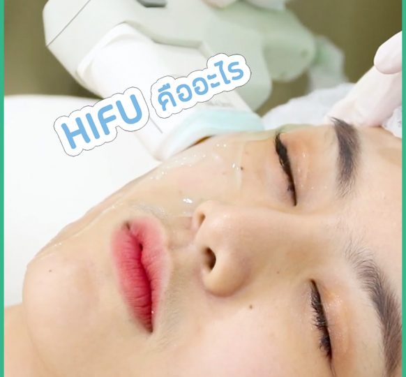 ทำความเข้าใจก่อนการทำ HIFU ช่วยลดเลือนริ้วรอยและผิวอ่อนเยาว์ลงได้จริงหรือ?